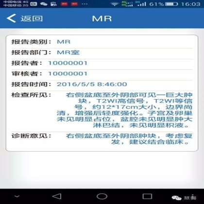 外阴侵袭性血管黏液瘤（刘从容老师分享、讲解）