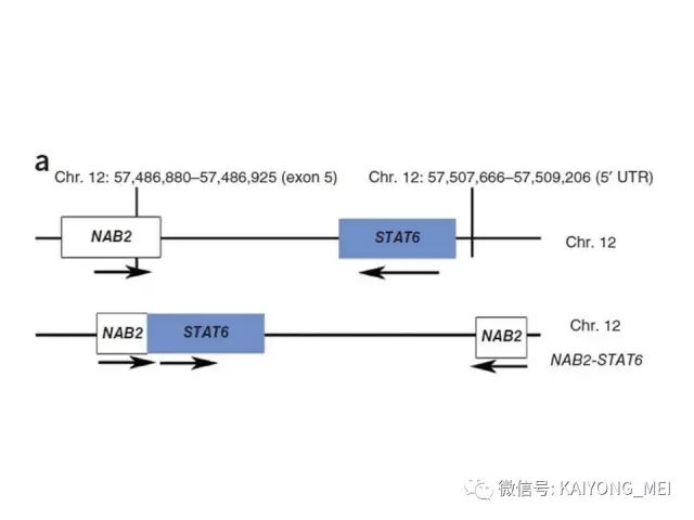 2016 WHO中枢神经系统肿瘤分类解读（四）