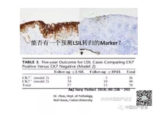独家专访国内妇产科病理大咖周先荣教授：子宫颈上皮内病变及相关临床情况的若干病理学问题（一）