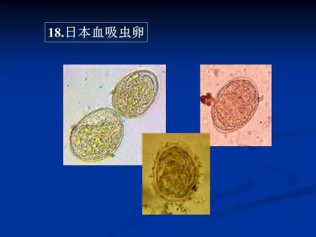 收藏！寄生虫图谱大全