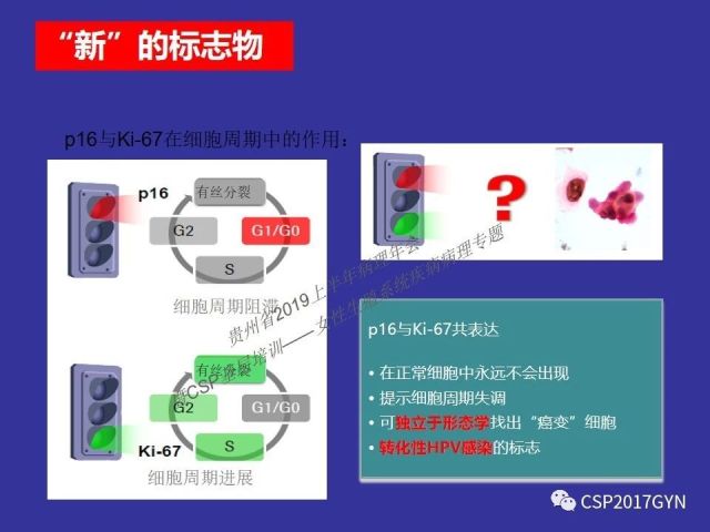 中华病理学会基层培训遵义站讲座（二）——宫颈细胞学诊断中陷阱与筛查进展