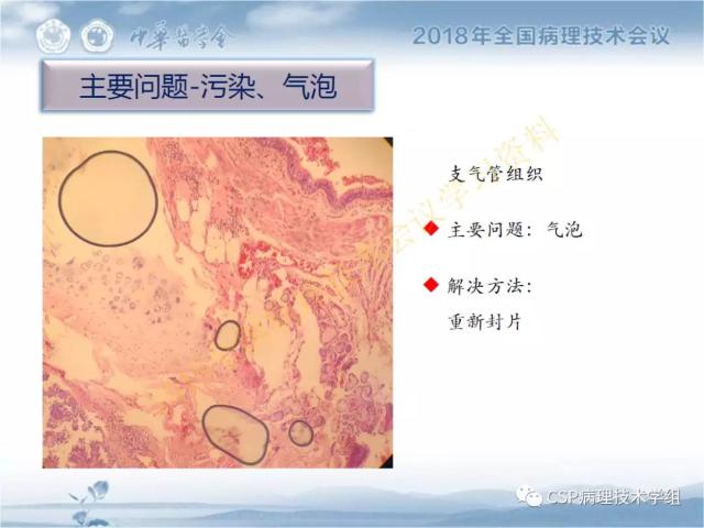 宋欣：HE切片质量控制及常见问题分析