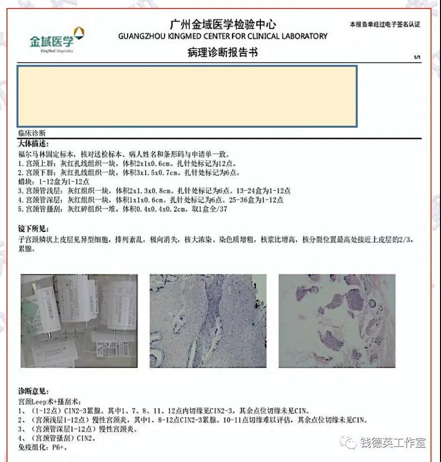 钱医生札记 | 宫颈锥切标本病理检查探讨