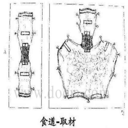病理标本取材规范