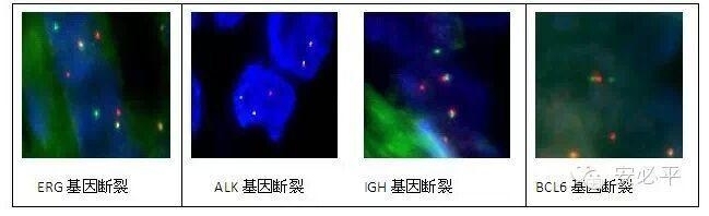 手把手教你建立FISH阈值